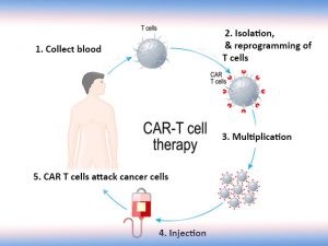 How Does CAR T-Cell Therapy Work? - Belong Cancer